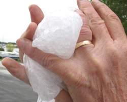 swollen finger with wedding ring still on: a man holds a bag of ice to his dislocated finger which quickly started to swell, but he did not know to take off his wedding ring
