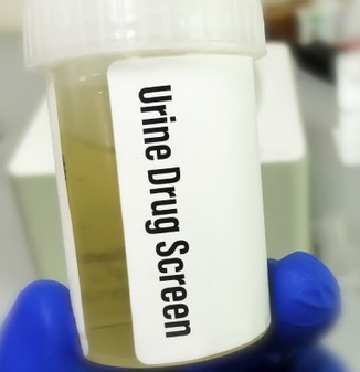 bottle says urine drug screen