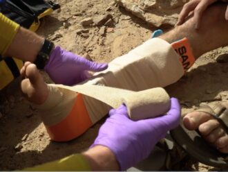 taping a SAM splint on an ankle